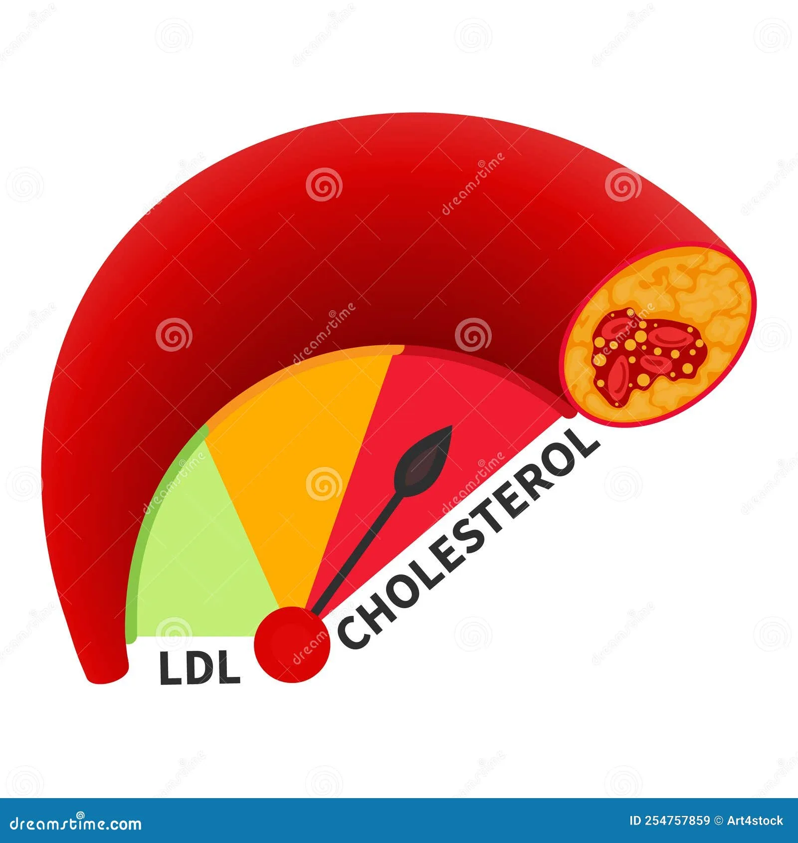 Ldl Cholesterol Level Meter Gauge With Blood Vessel Diagram Cartoon Vector