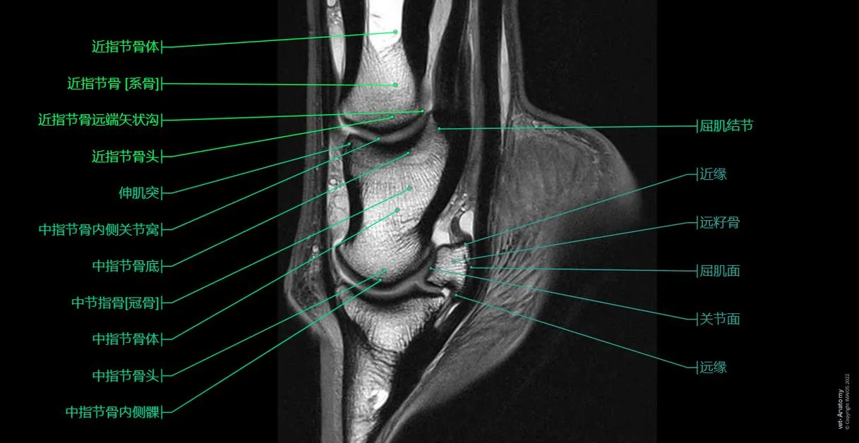 马足和马蹄Mri解剖图 正常解剖 Vet Anatomy