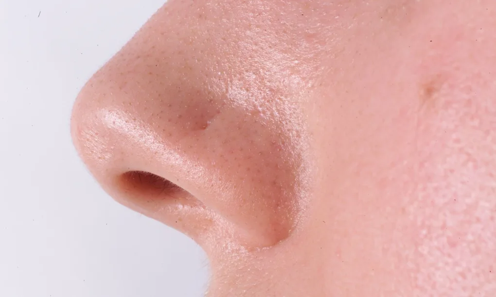 Nose Pictures