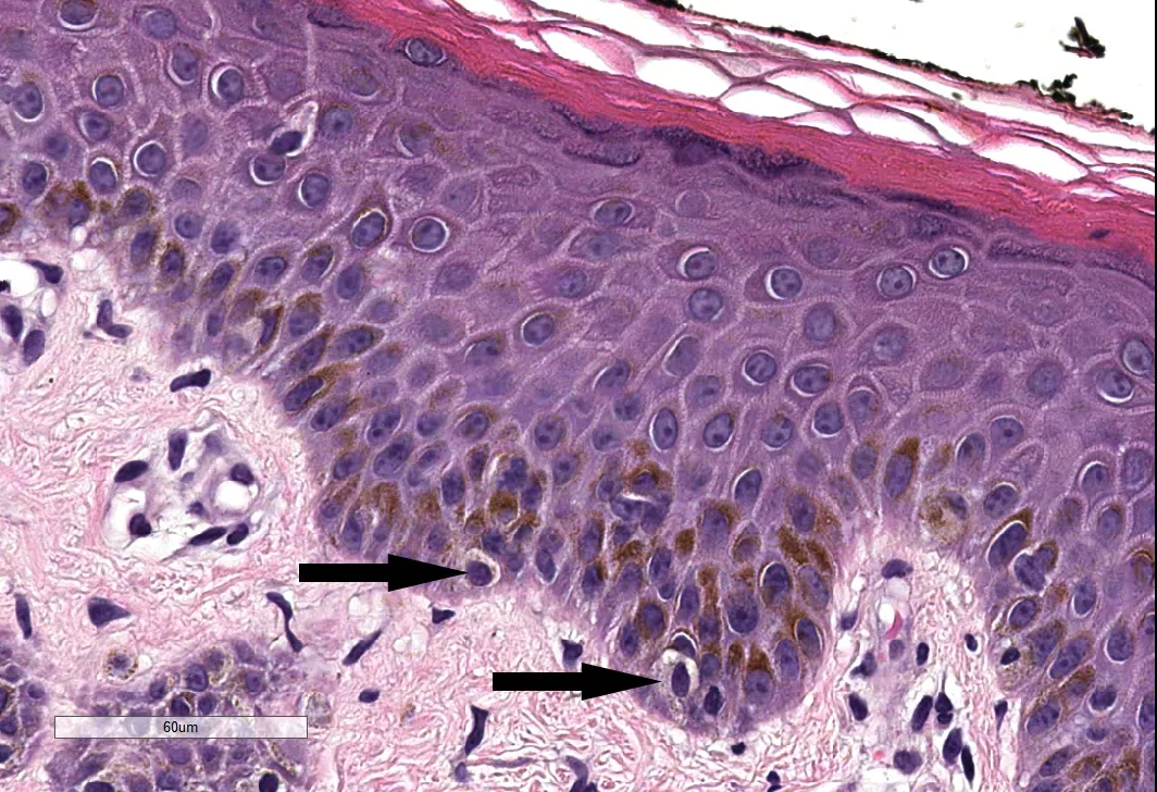 Pathology Outlines Histology