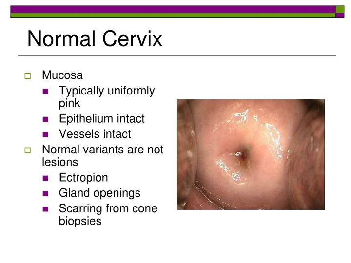 Ppt Clinical Considerations Powerpoint Presentation Id 1569779