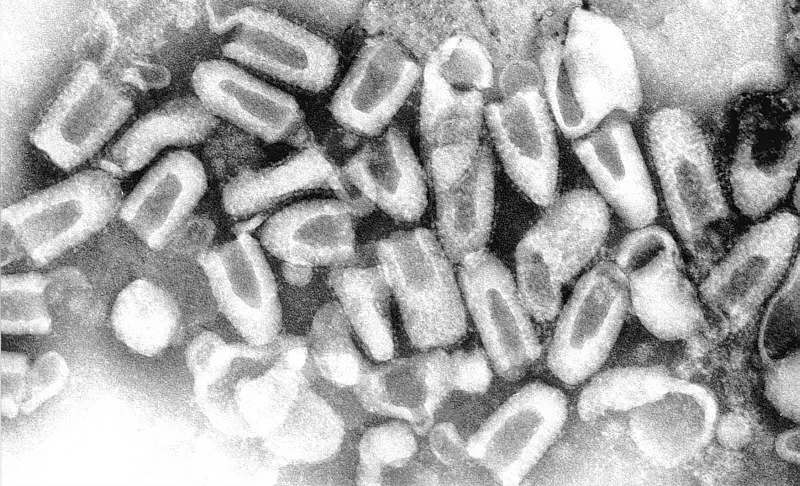 Rabies Virus Diagram