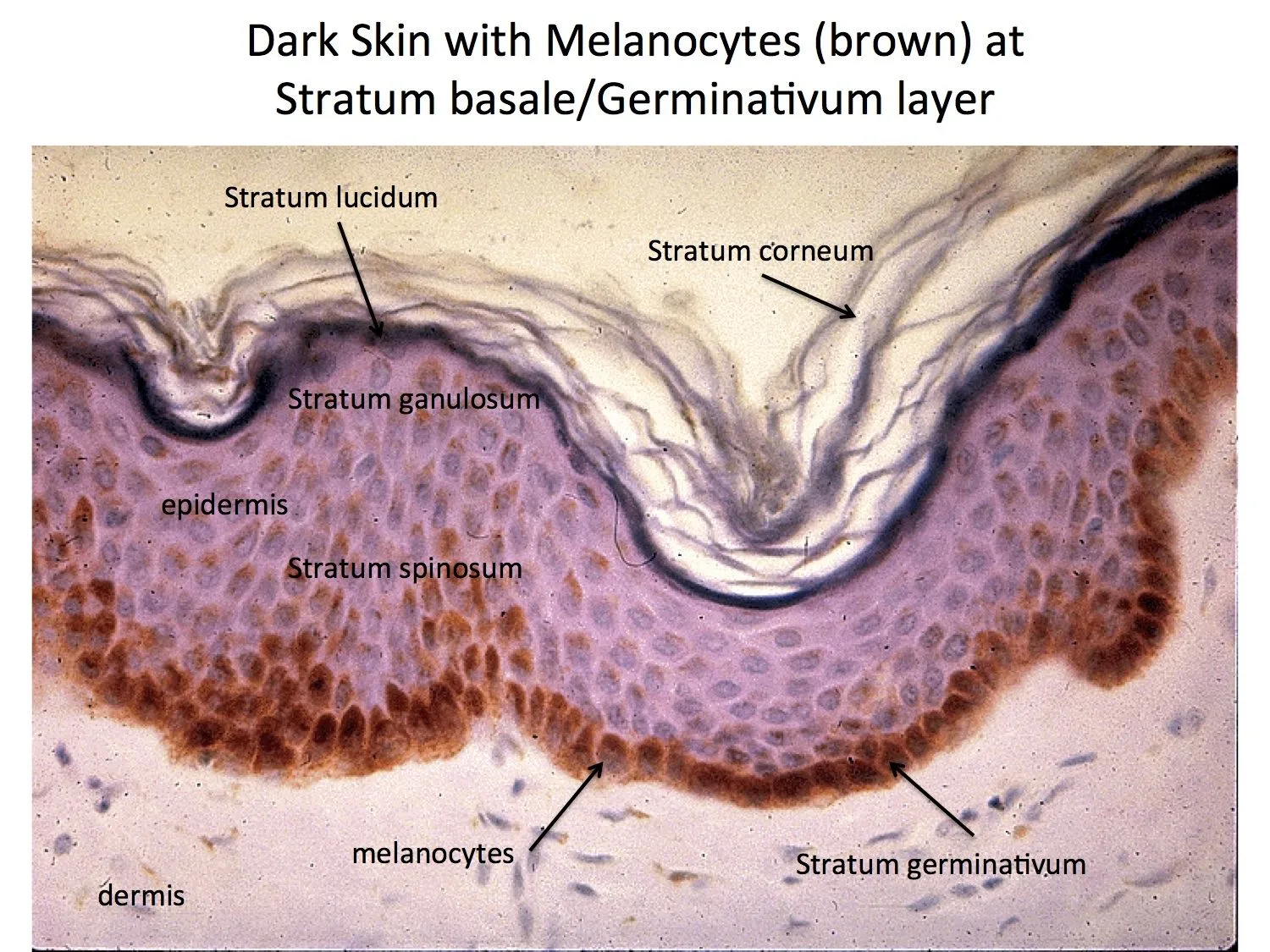 Skin Melanocytes And Epidermal Layers Histology Medical Laboratory Medical Science Health