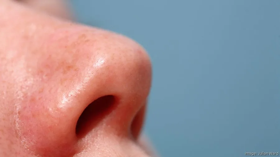 Startup Spirair Looks Ahead To Key April Decision For Deviated Septum Device San Francisco
