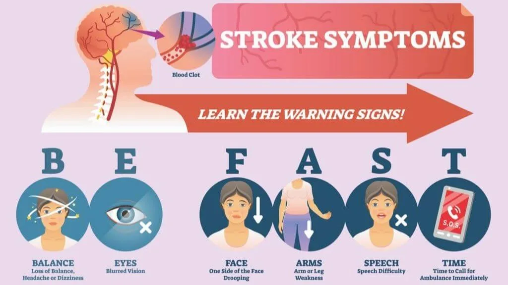 Stroke Types Symptoms And Long Term Outlook 1Md Nutrition