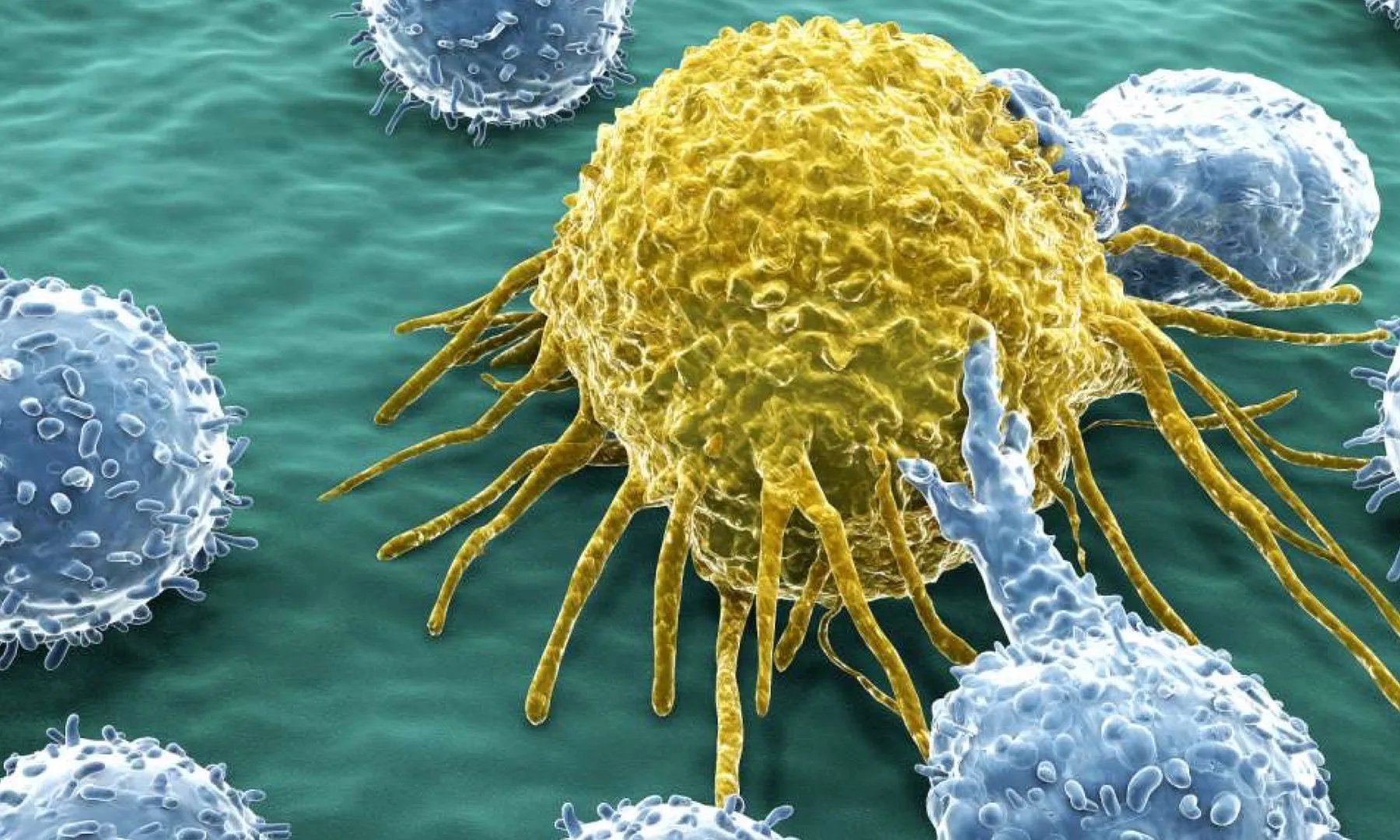 The Eight Important Points Of Cancer 6 From First Sensation To Development And The Mistake