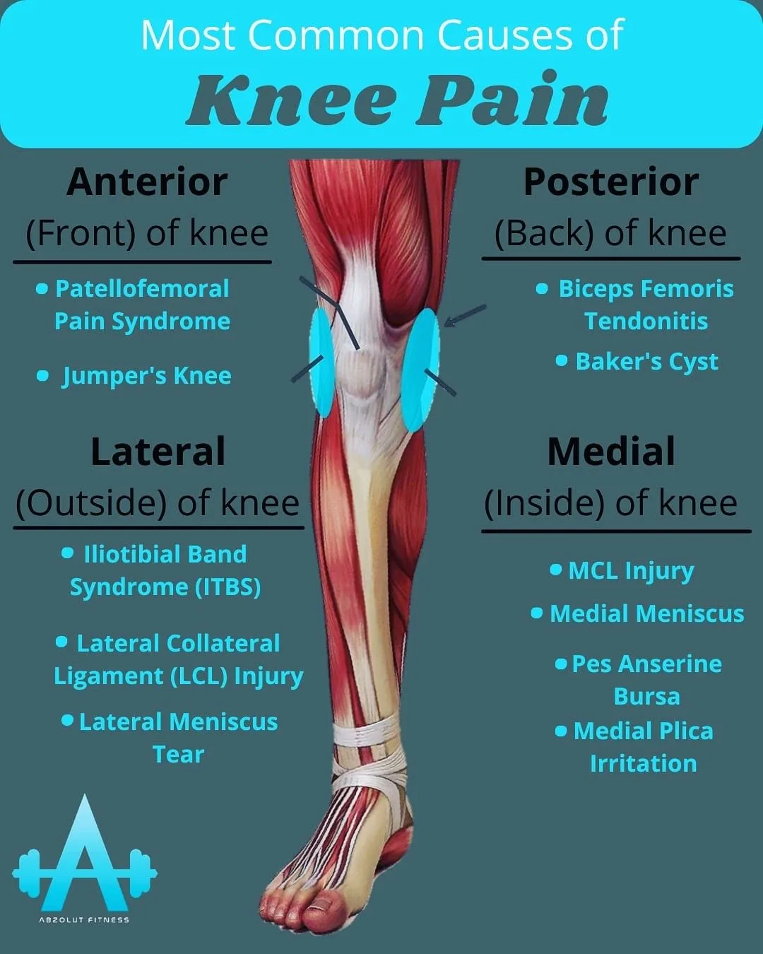 The Knee Pain Diagram Artofit