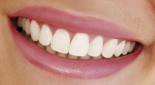 Top Tips From Dr Ramin Tabib To Keep Your Teeth Healthy Pretty Connected