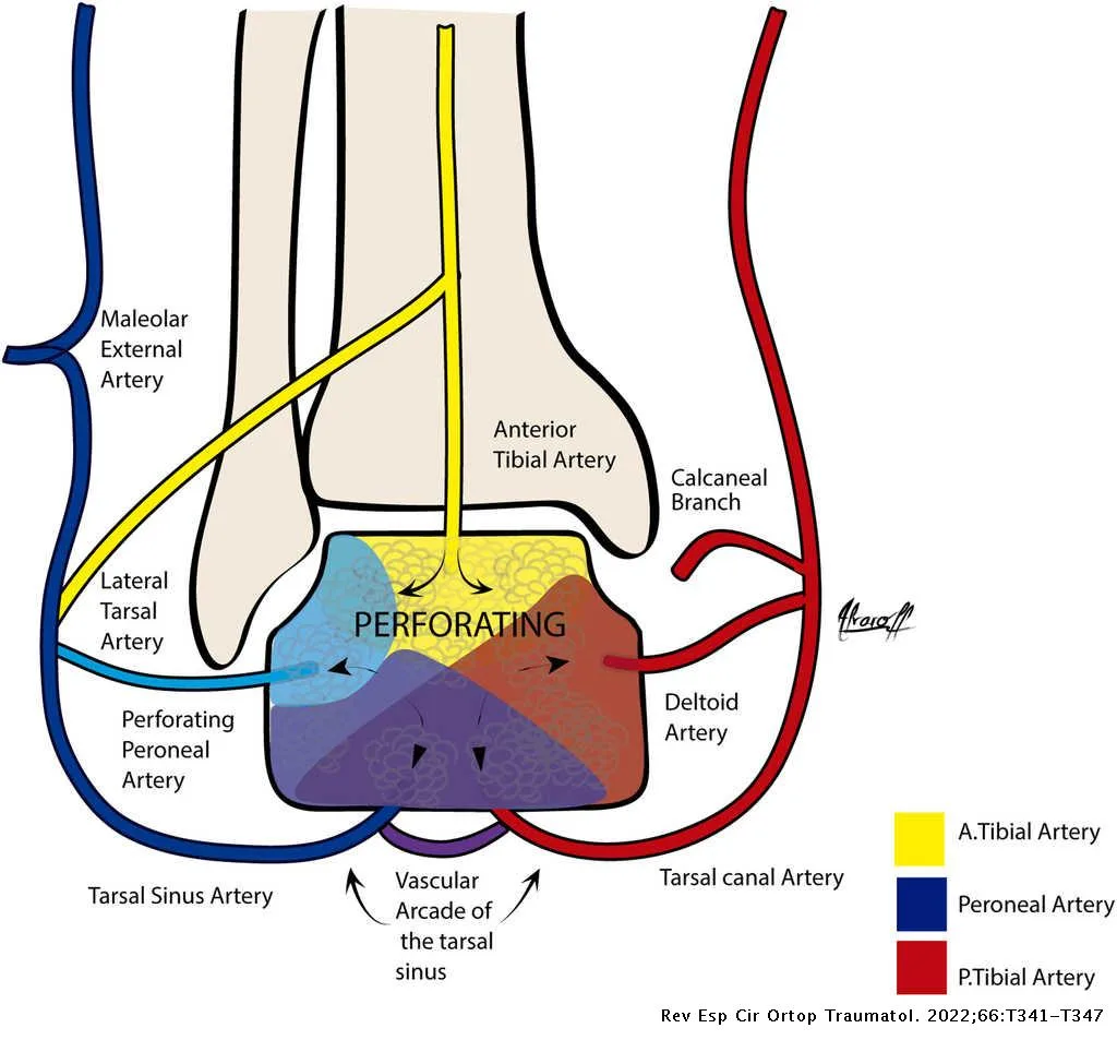 Translated Article Graphic Representation Of Intraosseous And Extraosseous Talus Blood Supply