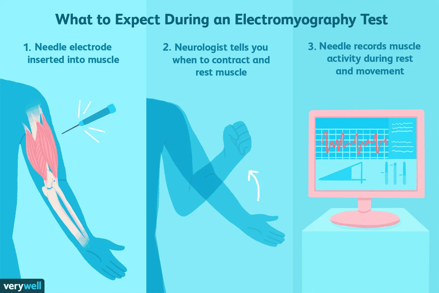 Understanding Ncs And Emg Test Results
