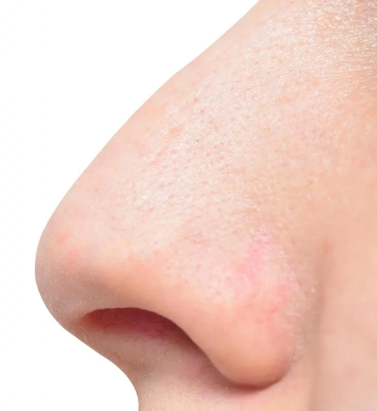What Is A Nose Job With Pictures