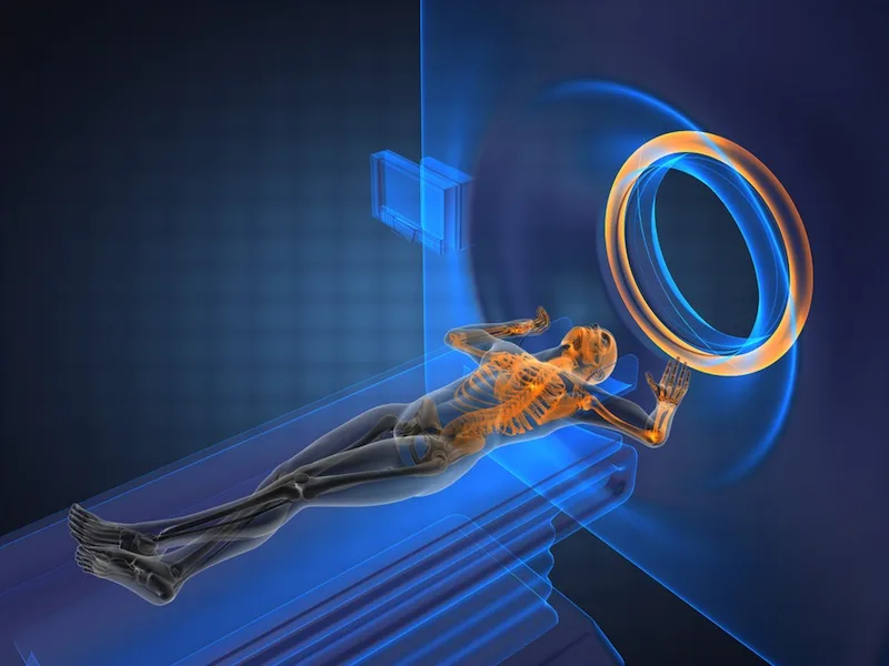 What Is An Mri Magnetic Resonance Imaging Live Science